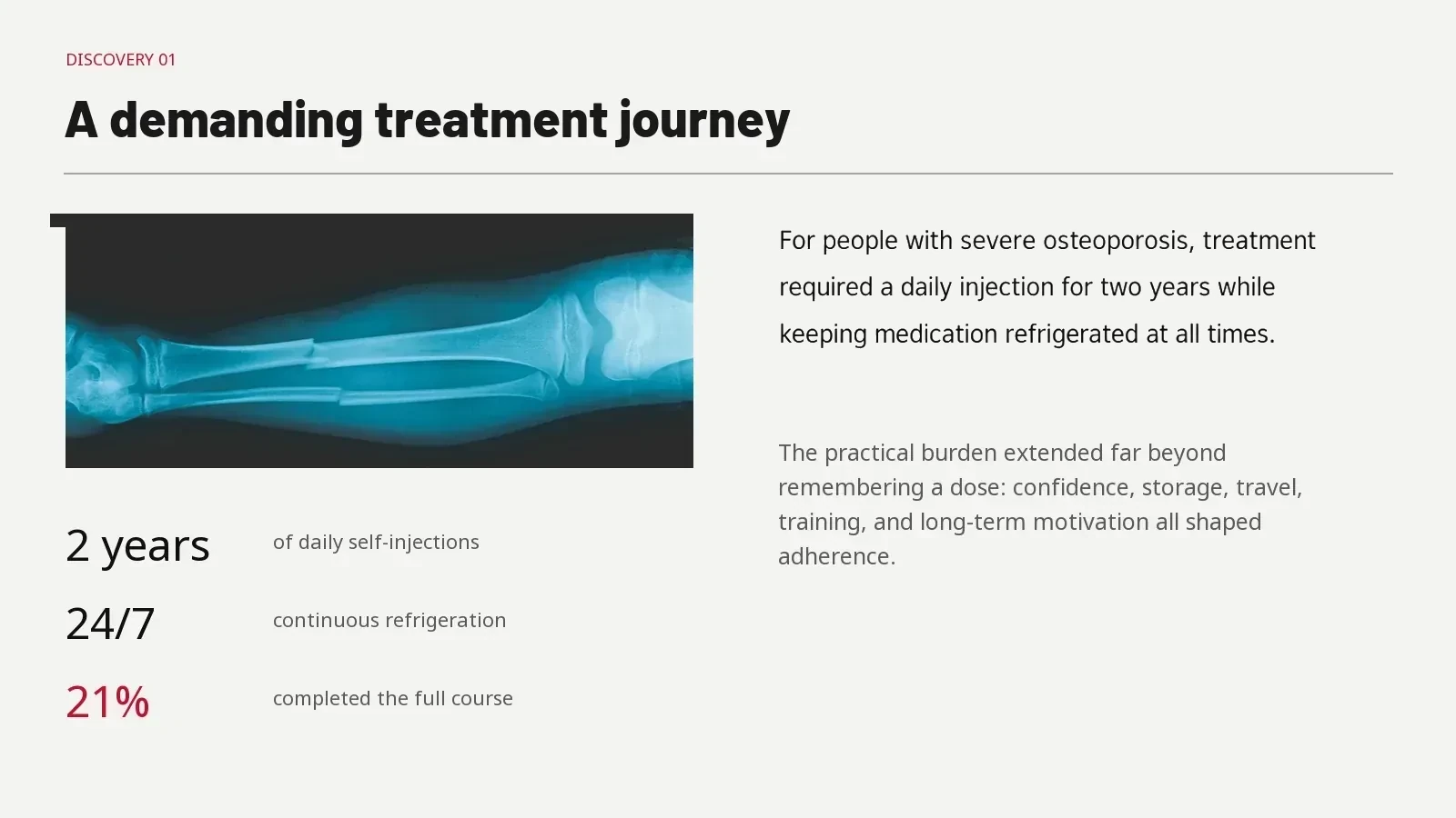 A demanding treatment journey. Daily self-injection and continuous refrigeration shaped the treatment context.